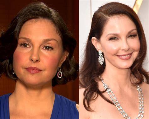 ashley judd plastic surgery|Ashley Judd fires back over plastic surgery rumors